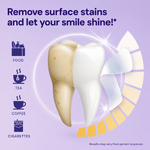 Whitening Strips