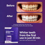 Whitening Strips